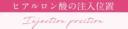 ヒアルロン酸の注入位置